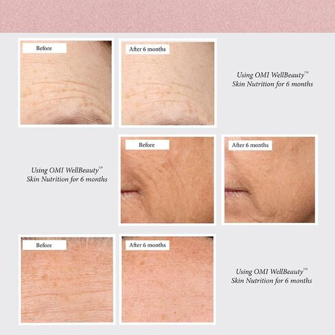 OMI Skin Nutrition، ثبت سريريًا أنه يزيد المرونة ويقلل العلامات المرئية لشيخوخة الجلد، الإيلاستين البحري الفرنسي، الكولاجين، حمض الهيالورونيك، فيتامين C، كمية تكفي لمدة شهر واحد، 3.17 أونصة in Saudi Arabia