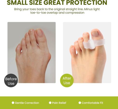 Toe Separators Bunion Corrector - 8 Pack Big Toe Spacers with 2 Loops, Suitable for Bunion and Overlapping Toes, Reduce Foot Pain(White) in Saudi Arabia