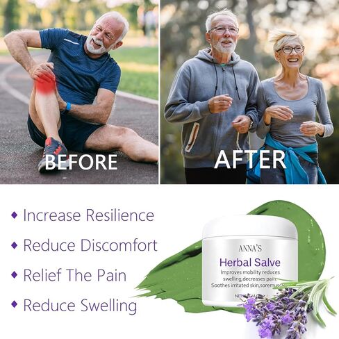 ANNA'S Herbal Salve 4.02oz - Organic Herbal Salve, Comfrey Organic Herbal Salve, Organic Comfrey Ointment for Bone Healing 1pcs in Saudi Arabia