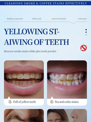 معجون أسنان SP-7WHITENING(أحمر) لتنظيف الفم ومضاد للتسوس in Saudi Arabia