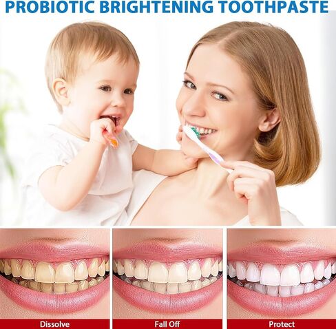 ​2Pcs Sp-6 Probiotics Toothpaste,Sp-6 Ultra Whitening Toothpaste,Probiotics Bright Toothpaste,Sp-6 Brightening Probiotics in Saudi Arabia
