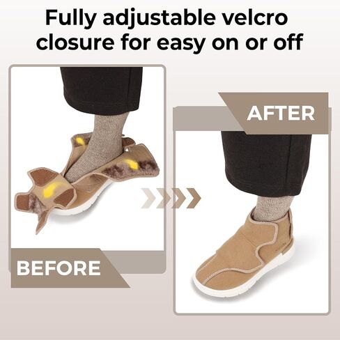 FitVille Diabetic Boots for Women Wide Width Fully Adjustable Straps Winter Boots for Women Wide Width with Warm Fur Lining Diabetic Shoes for Women Extra Wide Width Foot Pain Relief Neuropathy in Saudi Arabia