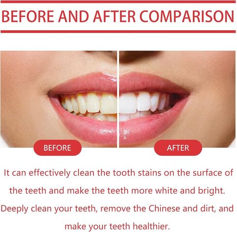 Sp8 Toothpaste, SP6 Ultra Whitening Toothpaste, Sp-8 Pasta Dental, Sp-8 Probiotic Toothpaste Whitening (1Pack) in Saudi Arabia