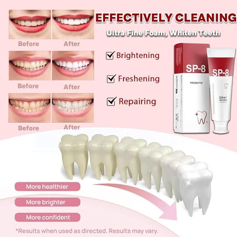 SP-8 Ultra Whitening Toothpaste, SP 8 Probiotic Toothpaste, Sp8 Probiotic Brightening Toothpaste, Fresh Breath, Deep Cleaning Care Toothpaste (2Pcs + 2* Toothbrush) in Saudi Arabia