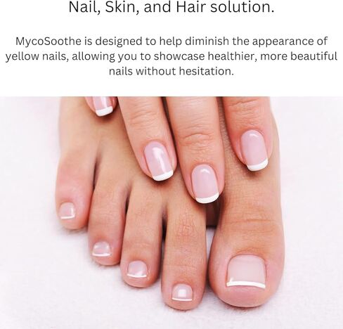 تركيبة MycoSoothe المتقدمة لدعم الشعر والبشرة والأظافر والمناعة - 60 كبسولة in Kuwait