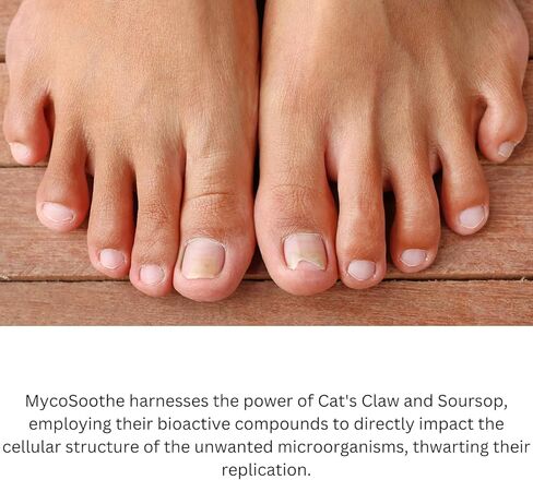 تركيبة MycoSoothe المتقدمة لدعم الشعر والبشرة والأظافر والمناعة - 60 كبسولة in Kuwait