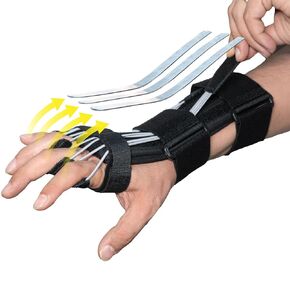 Pucka Radial Nerve Palsy Splint Adjustable Dynamic Drop Wrist and Finger Splint for Pain Mcp Arthroplasty Recovery Stroke Brace - Fits Right or Left Hand Splint