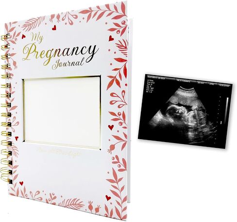 Pregnancy Journal Memory Book - 82 Pages Hardcover Pregnancy Book, Pregnancy Planner, Pregnancy Journals for First Time Moms, Baby Memory Book, Mom Book Diary, Ultrasound Baby Book Memory (Red leaves) in Saudi Arabia