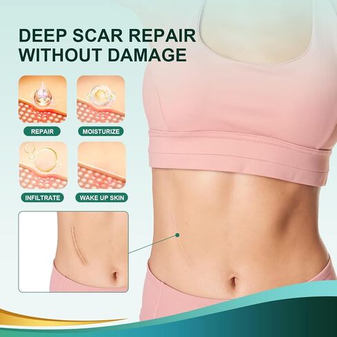 Medical Grade Silicone Scar Sheets, Silicone Scar Tape (1.6"x 120"), Professional Scar Removal Treatment, Reusable Silicone Scar Strip in Saudi Arabia