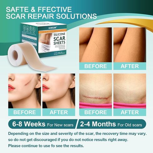Medical Grade Silicone Scar Sheets, Silicone Scar Tape (1.6"x 120"), Professional Scar Removal Treatment, Reusable Silicone Scar Strip in Saudi Arabia