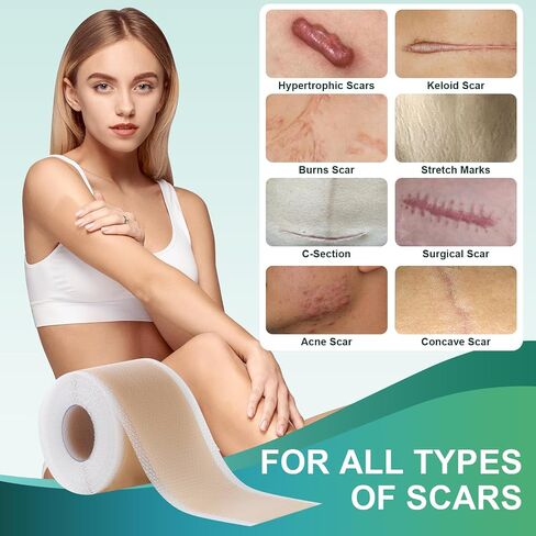Medical Grade Silicone Scar Sheets, Silicone Scar Tape (1.6"x 120"), Professional Scar Removal Treatment, Reusable Silicone Scar Strip in Saudi Arabia