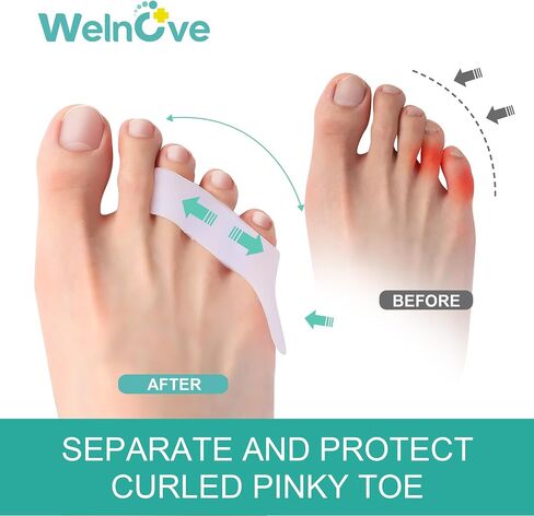 Welnove Gel Pinky Toe Separators - 8 Pack Pinky Toe Spacers, Bunion Cushions Pads for Women＆Men, Silicone Little Toe Protectors for Preventing Rubbing & Relieve Pressure(Beige) in Saudi Arabia