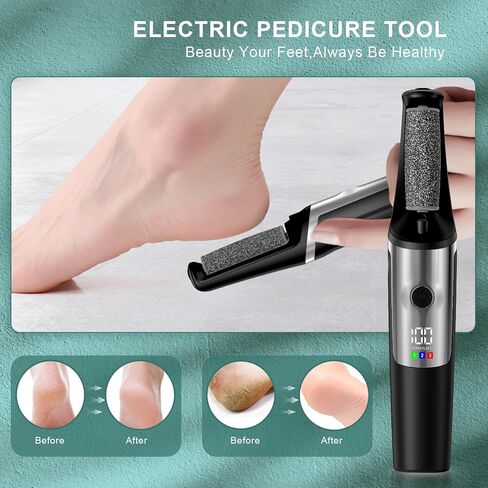 Electric Callus Removers for Feet, Smooth Pedicure Wand Rechargeable Electric Foot File,Professional Pedicure Tools for Dry, Dead, Cracked, Hard Skin, at Home Feet Spa Care Kit for Men & Women in Saudi Arabia