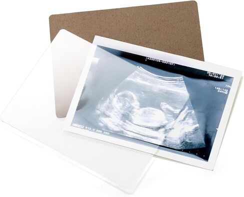 إطار صورة Hacaroa Sonogram مع أسابيع العد التنازلي، إطار خشبي للصور بالموجات فوق الصوتية لإعلان الحمل، ديكور حضانة الأطفال يكشف عن الجنس هدايا للأمهات لأول مرة، النساء الحوامل، أبيض in Kuwait
