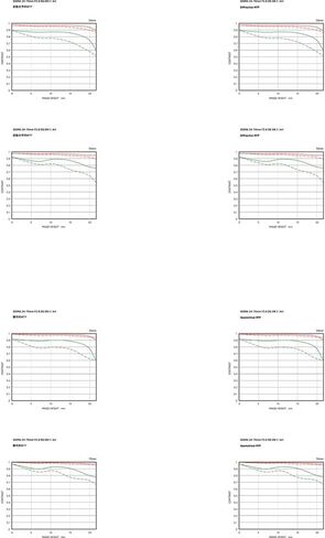 عدسة سيجما الفنية مقاس 24-70 مم f/2.8 DG DN II (سوني E) + طقم تنظيف + طقم مرشح عدسة 82 مم in Saudi Arabia