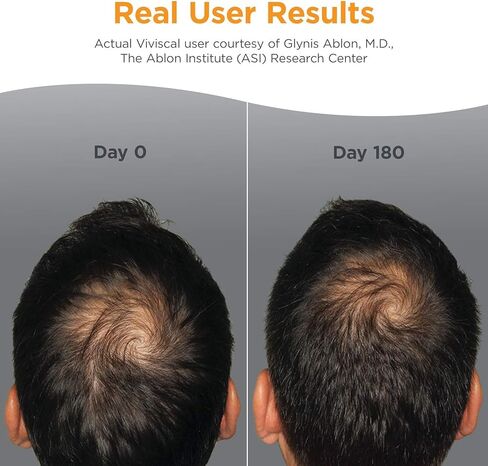Viviscal Men's Hair Growth Supplements for Thicker, Fuller Hair Clinically Proven with Proprietary Collagen Complex 180 Tablets - 3 Month Supply in Saudi Arabia