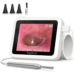 ScopeAround Otoscope Ear Camera, 3.9mm Otoscope with Light 720PHD Ear Scope,Digital Otoscope with 6 LED Lights for Kids and Adults