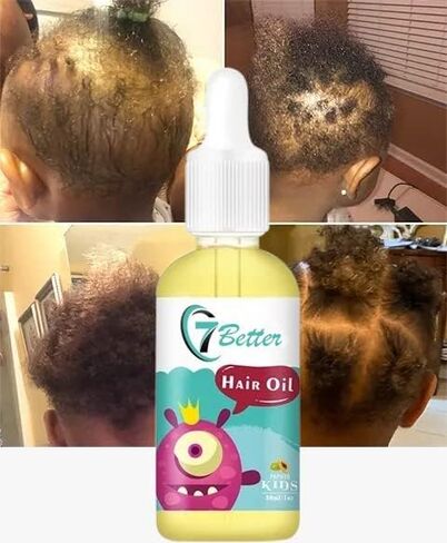 منتجات العناية بالشعر الطبيعية للأطفال، قوة إضافية لنمو وتغذية الأطفال، زيت مصل نمو الشعر، زيت الحبة السوداء لنمو قوي للشعر - سميك وكامل in Kuwait