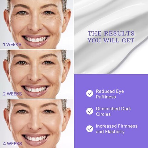 كريم العين بالكافيين للهالات السوداء والانتفاخ - كريم العين المرطب بالكولاجين ليلاً ونهارًا للتجاعيد - تأثير شد البشرة ومقاومتها للشيخوخة - علاج الانتفاخات تحت العينين للنساء والرجال - مزيل ومصحح in Kuwait