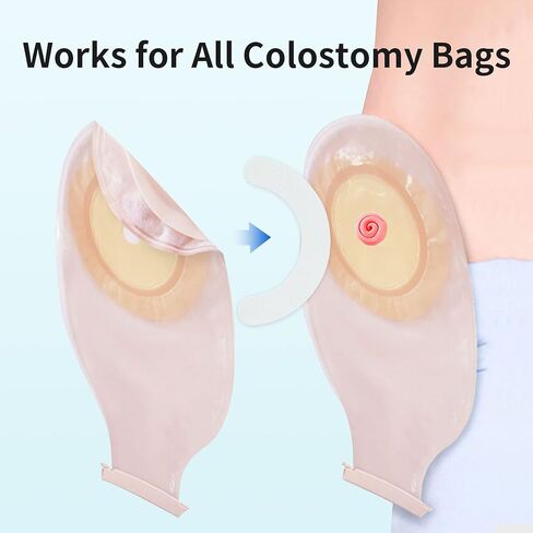 40Pcs Ostomy Barrier Strips for Colostomy Bags, Y-Shaped Barrier Adhesive Strips, Barrier Extender of Ostomy Supplies in Kuwait