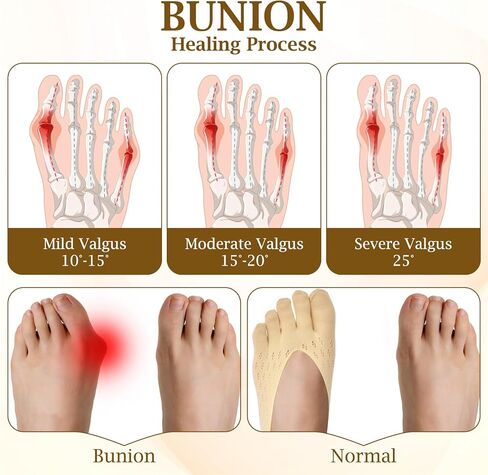 5Pairs Bunion Socks for Women, Bunion Relief Toe Separator Socks Toe Alignment Socks for Bunion Correction, Bunions Compression Toe Socks, Orthopedic Toe Compression Socks Foot Alignment Socks in Saudi Arabia