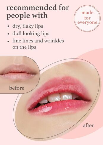 NOONI Korean Lip Oil - Appleberry | Lip Stain, Gift, Moisturizing, Revitalizing, and Tinting for Dry Lips with Raspberry Fruit Extract, 0.12 Fl Oz in Kuwait