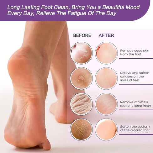 Foot Soak Salts with Epsom Salt for Soaking Lavender Pedicure Foot Bath- 20 Pack Bath sea Salts Foot spa Products kit 21 oz in Kuwait
