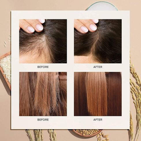 ProBliva Hair Growth Serum, Rice Water Spray for Hair Growth, Rice Water for Hair Growth, Hair Growth for Women, Rice Water for Hair, Hair Loss Treatments for Women, with Biotin and Caffeine in Saudi Arabia