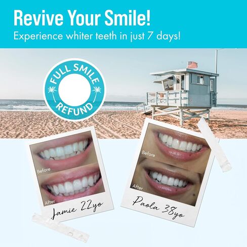 Cali White Teeth Whitening Strip Kit with LED Light + Batteries - Organic Peroxide Teeth Whitening Gel - Set of White Strips for Teeth Whitening - 2x5ml Syringes, Thermoform Whitening Trays & Case in Saudi Arabia