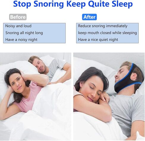 Anti Snoring Chin Strap,Chin Strap for cpap Users,Anti Snoring Devices, Sleep Aid for Men and Women，Breathable Stop Snoring Chin Strap Snoring Solution for Users to Keep Mouth Closed in Saudi Arabia