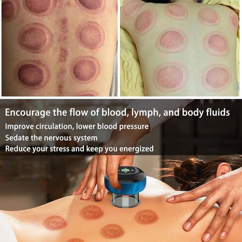 Electric Cupping Therapy Set, Smart Cupping Therapy Massager, Electric Cupping Device with 12 Level Suction and Temperature, Portable Smart Dynamic Cupping Set in Saudi Arabia