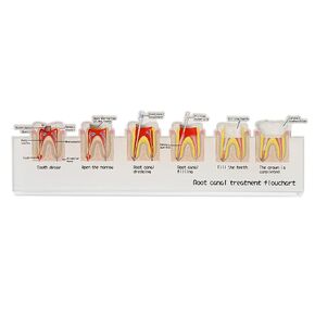 Dental Root Canal Treatment Flowchart Stand, Periodontal Disease Process Model Illustration for Dental Lab Teaching Demo, Dentist Gifts (Type 2)