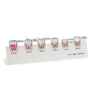 Dental Root Canal Treatment Flowchart Stand, Periodontal Disease Process Model Illustration for Dental Lab Teaching Demo, Dentist Gifts (Type 2)