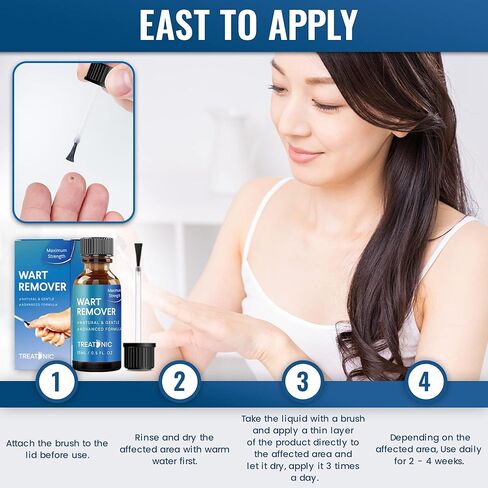 مزيل الثآليل ذو القوة القصوى: إزالة الثآليل سريعة المفعول، مزيلات الثآليل الأخمصية بدون ألم، شائعة، علاج الثآليل المسطحة بالتجميد in Kuwait