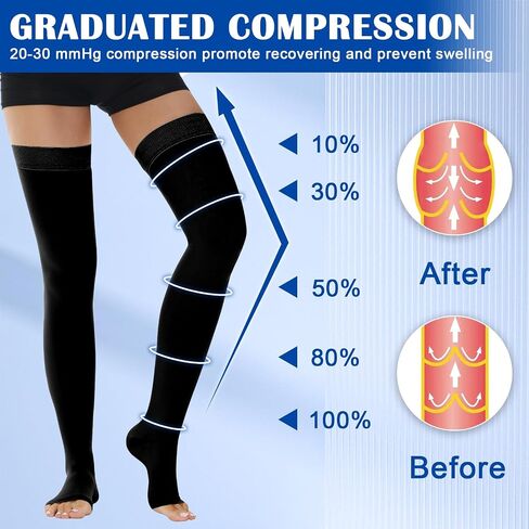 Ailaka Thigh High Medical Compression Stockings for Women Men, Open Toe Firm 20-30 mmHg Graduated Compression with Silicone Band for Varicose Veins, Edema, Post-Surgery in Kuwait
