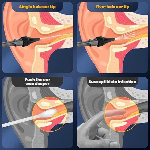 Ear Wax Removal - Electric Ear Cleaner - Ear Cleaning Kit - FSA HSA Eligible - Ear Irrigation Kit Safe Ear Irrigation Flushing System with 4 Pressure Settings - FSA Eligible Items Only List in Saudi Arabia