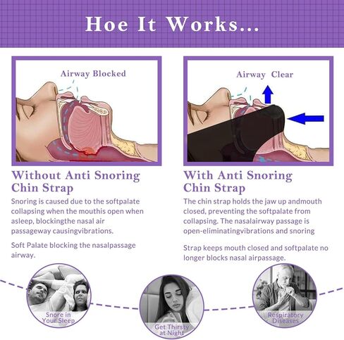حزام الذقن للنوم، أجهزة توقف التنفس أثناء النوم، حزام فك مريح لتدفق الهواء لتوقف التنفس أثناء النوم، حزام ذقن قابل لإعادة الاستخدام للرجال والنساء، حزام ذقن مضاد للشخير قابل للتنفس in Kuwait