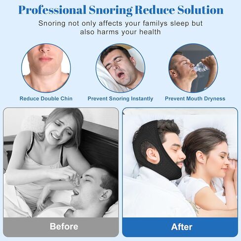 Chin Strap for Sleeping, Premium Anti-Snoring Chin Strap, Sleep Apnea Devices for Better Rest, Snoring Solution for Men and Women to Keep Mouth Closed, Comes with Extension Strap, Black, 21.6in in Saudi Arabia