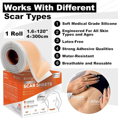شريط أوراق الندبات السيليكون من aZengear (بكرة 1.6 × 120 بوصة) للندبات الجراحية، والجُدرات، والقسم C، وشد البطن، وعلاج إزالة الندبات القديم الجديد، ورقع طبية، تم اختباره بواسطة HRIPT in Kuwait