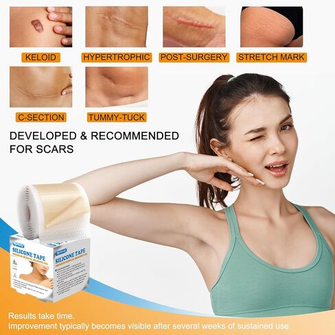 صفائح الندبات المصنوعة من السيليكون، بكرة شريط الندبات من جل السيليكون (1.6 بوصة × 59 بوصة - 1.5 متر) - شرائط إزالة الندبات المصنوعة من السيليكون المقاومة للماء وقابلة لإعادة الاستخدام للقسم القيصري والجُدرَة وعلامات التمدد وشفاء الندبات in Kuwait