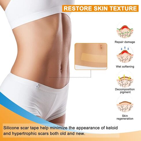 صفائح الندبات المصنوعة من السيليكون، بكرة شريط الندبات من جل السيليكون (1.6 بوصة × 59 بوصة - 1.5 متر) - شرائط إزالة الندبات المصنوعة من السيليكون المقاومة للماء وقابلة لإعادة الاستخدام للقسم القيصري والجُدرَة وعلامات التمدد وشفاء الندبات in Kuwait