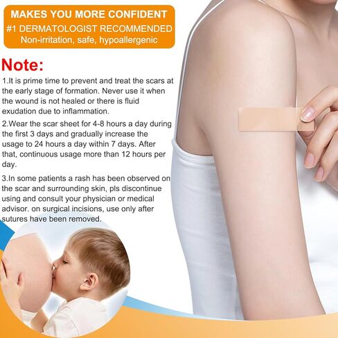 صفائح الندبات المصنوعة من السيليكون، بكرة شريط الندبات من جل السيليكون (1.6 بوصة × 59 بوصة - 1.5 متر) - شرائط إزالة الندبات المصنوعة من السيليكون المقاومة للماء وقابلة لإعادة الاستخدام للقسم القيصري والجُدرَة وعلامات التمدد وشفاء الندبات in Kuwait