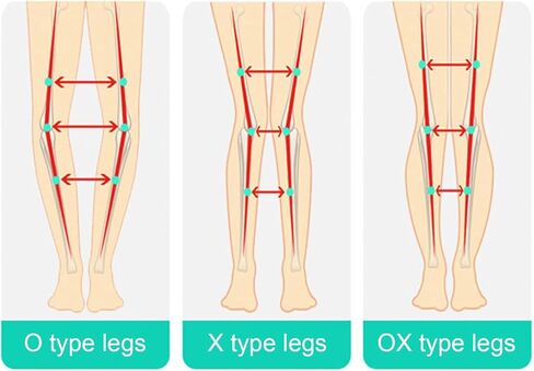 Leg Correction Belt, Polyurethane Leg Corrector Strap, High Elasticity Straighten Beauty O X Type Leg Correction Bandage for Adults(M) in Saudi Arabia