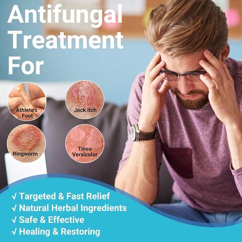 Antifungal Cream, All Natural Herbal Anti Fungal Skin Cream for Athlete's Foot, Jock Itch, Ringworm, Tinea Versicolor, Fungal Infection, 3.53 OZ in Kuwait