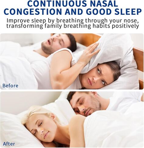 شرائط الأنف للشخير، أجهزة مكافحة الشخير للرجال والنساء، شرائط الأنف للتنفس لتحسين النوم، وتحسين تدفق الهواء وملاءمة مريحة (60 عبوة) in Kuwait