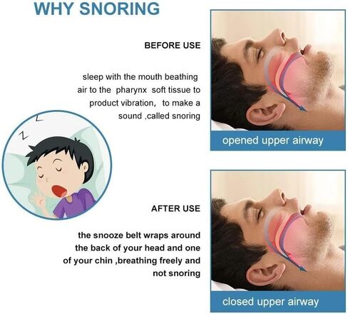 Anti Snoring Chin Strap | Anti-Snoring Chin Strap for Better Sleep | Adjustable and Comfortable Snore Stopper for Men & Women | Itch-Free Fabric, Keeps Mouth Closed, Enhances Sleep Quality in Saudi Arabia