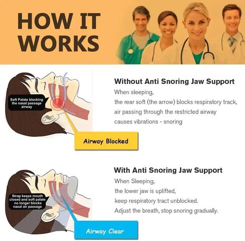 Anti Snoring Chin Strap | Anti-Snoring Chin Strap for Better Sleep | Adjustable and Comfortable Snore Stopper for Men & Women | Itch-Free Fabric, Keeps Mouth Closed, Enhances Sleep Quality in Saudi Arabia