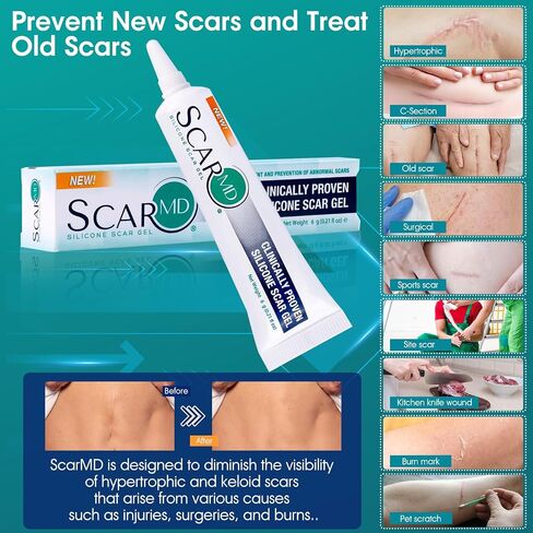Scar Gel Scar Cream, Keloid Bump Removal, Advance Scar Gel for Surgical Scars,Body,Leg, Burns,C-Section, Stretch Marks, Reduces Discomfort, 0.21oz in Saudi Arabia