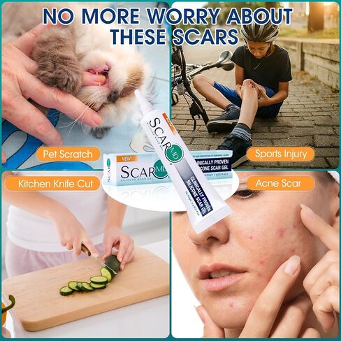 Scar Gel Scar Cream, Keloid Bump Removal, Advance Scar Gel for Surgical Scars,Body,Leg, Burns,C-Section, Stretch Marks, Reduces Discomfort, 0.21oz in Saudi Arabia