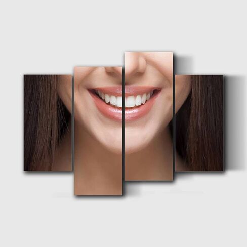 NCDIALHDFU Canvas Wall Art Woman smile Teeth whitening Dental care Photo Prints Realism Artworks Modern Wall Decor for Living Room Clinic Office Gift for Dental Students Dentist Nurses in Saudi Arabia